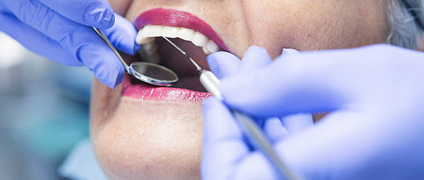 Best Emergency Broken Tooth Repair in Kendall, FL